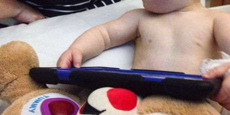 3-godišnji Corey Alway boluje od dva rijetka genetska poremećaja (Foto: Profimedia)