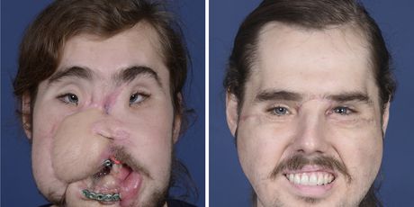 Iznimno uspješna rekonstrukcija lica (Foto: Profimedia)