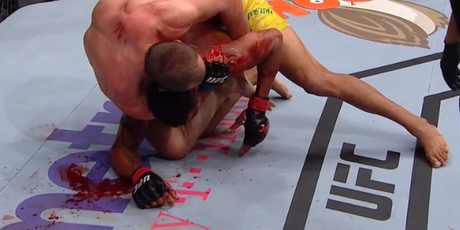 Krv curi iz čela Oliveire