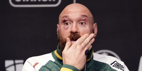 Tyson Fury