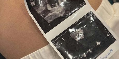 Ivona i Dado Polumenta - 4