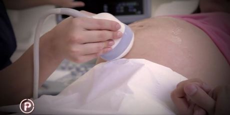 Ultrazvuk trudnice