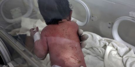 Beba rođena pod ruševinama u Siriji - 1