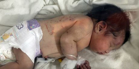 Beba rođena pod ruševinama u Siriji - 3