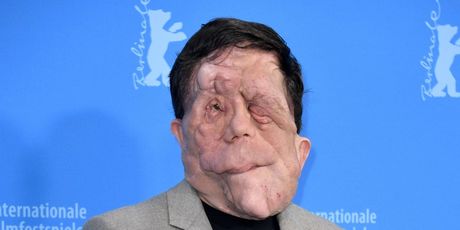 Adam Pearson - 4