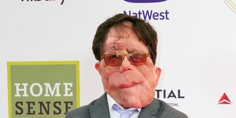 Adam Pearson - 5