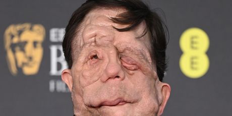 Adam Pearson - 6