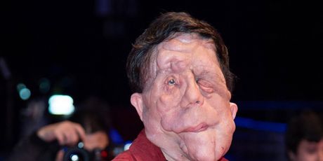 Adam Pearson - 8