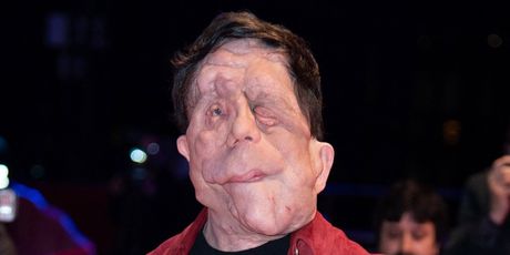 Adam Pearson - 9