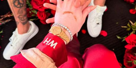 Winnie Harlow, Kyle Kuzma