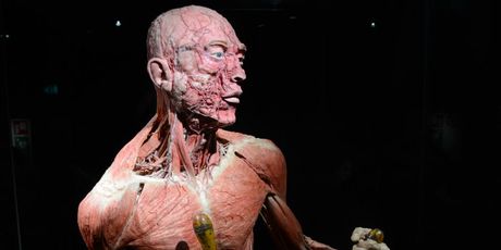 Body Worlds Amsterdam - 3