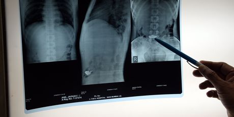 Otkriće x-zraka (Foto: AFP)