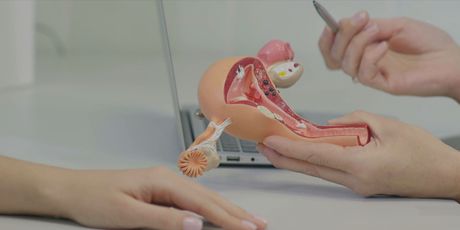 Prevencija raka vrata maternice: Ilustracija - 6