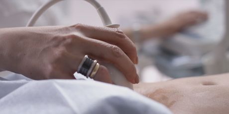 Prevencija raka vrata maternice: Ilustracija - 7