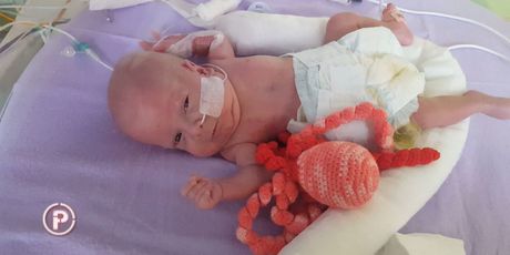 Medicinski uspjeh: najmanja beba preživjela tešku operaciju (Foto: Dnevnik.hr) - 6