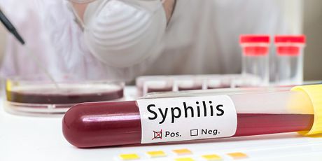 Broj oboljelih od sifilisa u Europi porastao za 70% (Foto: Getty Images)
