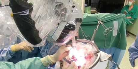 U KBC-u Split uspješno obavljena zahtjevna operacija moždane aneurizme - 1