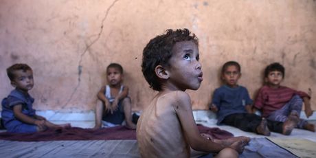 Djeca gladuju u Gazi