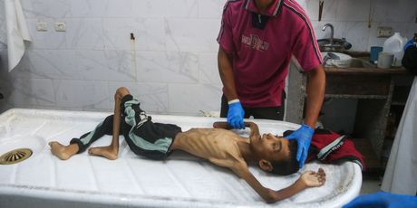 Dječak (14) u Gazi umro je od gladi