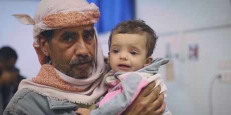 Djeca u Jemenu trebaju pomoć (Foto: Dnevnik.hr) - 1