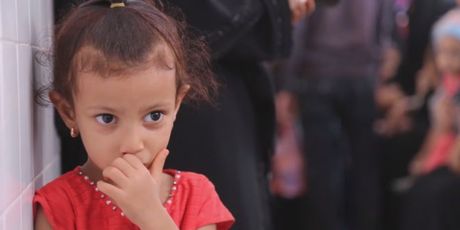 Djeca u Jemenu trebaju pomoć (Foto: Dnevnik.hr) - 4