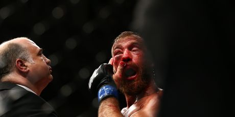 Zatvoreno oko Donalda Cerronea (Foto: AFP)