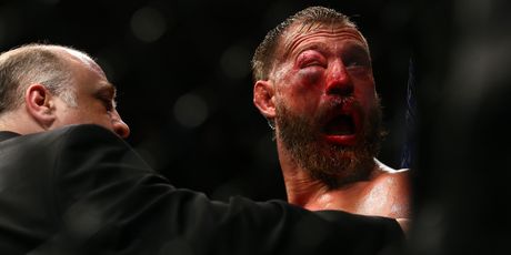 Zatvoreno oko Donalda Cerronea (Foto: AFP)