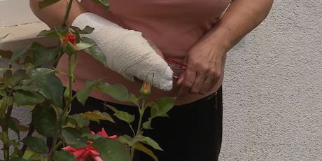 Ozljeđena ruka Mare Begonje (Foto: Dnevnik.hr)
