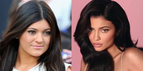 Kylie Jenner nekad i sad