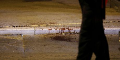Muškarac izboden nožem u središtu Splita - 5