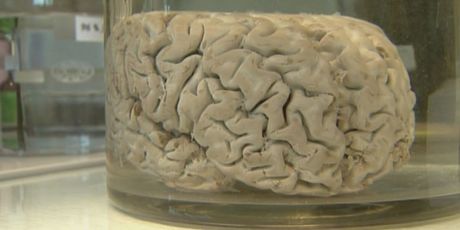 Tjedan mozga (Foto: Dnevnik.hr) - 3