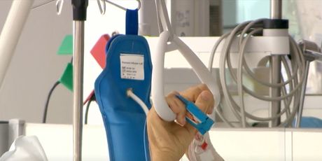 Operacija pomoću robotske ruke - 3