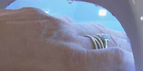 Geliranje noktiju, ilustracija - 1