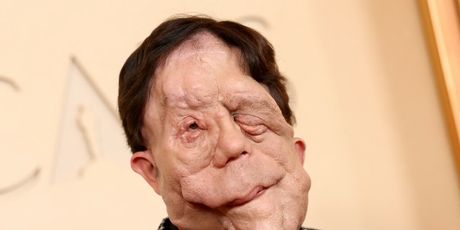 Adam Pearson - 1