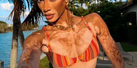 Winnie Harlow - 2