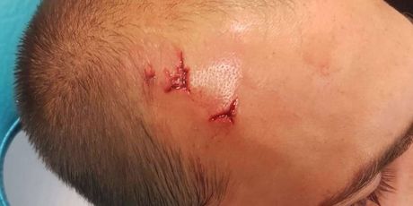 Razbijena glava Bas Dosta (Screenshot)