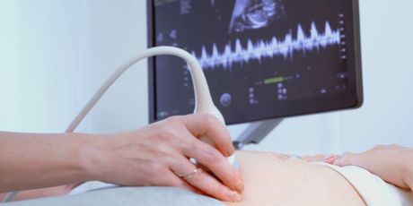 Ultrazvuk trudnice