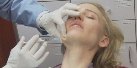 Botoks, Ilustracija - 1