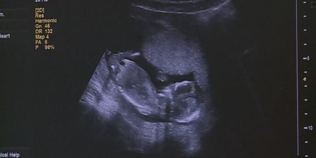 Prva beba s tri roditelja, ilustracija - 3