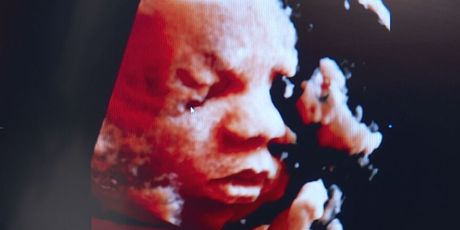 Prva beba s tri roditelja, ilustracija - 4