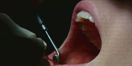 Higijena zubi, ilustracija - 1