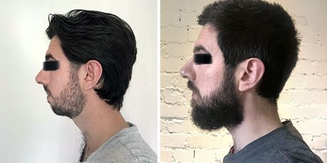 Brada čini čovjeka - 26