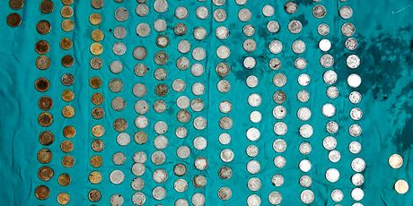 Liječnici su iz želuca izvadili 263 kovanice (FOTO: Profimedia)