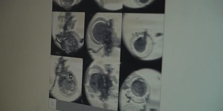 Genetski modificirane bebe (Foto: Dnevnik.hr) - 1