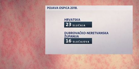 Pojava ospica 2018. godine (Foto: Dnevnik.hr)