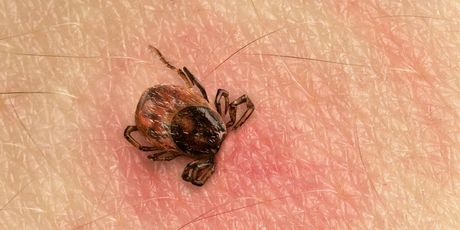 Ubod krpelja (Ilustracija: Getty)