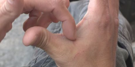 Čip u ruci (Foto: Dnevnik.hr)