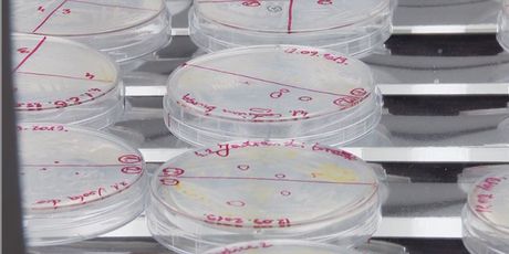 Uzorci algi (Foto: Dnevnik.hr)