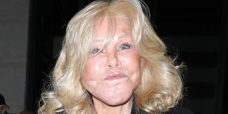 Jocelyn Wildenstein