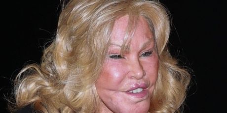 Jocelyn Wildenstein - 3